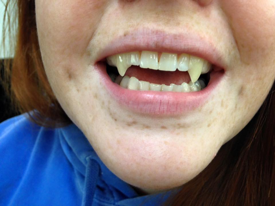 Sexy Bite Fangs